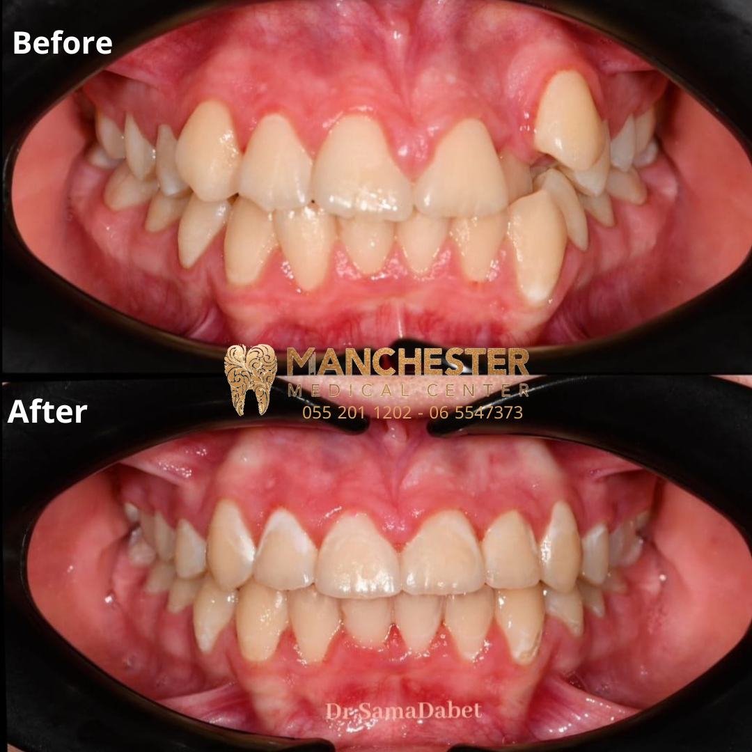Manchester Medical Centre-Veneers, Implants & Invisalign Dentist in Sharjah